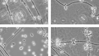 Lichtmikroskopische Bilder des Hefepilzes Candida albicans (DSM 1386); Quelle: DSMZ