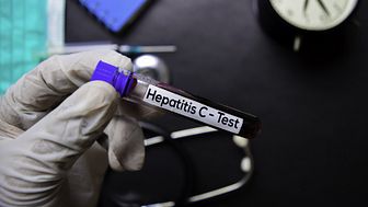 Globalt beräknas cirka 70 miljoner individer ha en hepatit C-infektion.