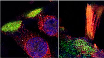 Super-resolution structured illumination microscopy (SR-SIM) show critical proteins in human hair cells associated with age-related hearing loss. Foto Dr Wei Liu