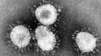Bild tagnen av coronavirus i elektronmikroskop, där virusets ”proteinspikar” påminner om den ljuskrans vi ser runt solen vid solförmörkelse och som kallas just korona, och därav namnet på viruset. Foto: Wikimedia Commons, CDC/Dr. Fred Murphy