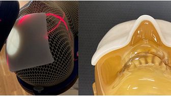 Developed a novel, “Soft Rubber Bolus” for radiation therapy - Easily shapable by hand, leading to high-precision irradiation and more adapted treatment -- Kindai University