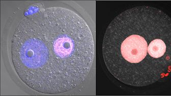 Specialized structure inside fertilized egg discovered by this research. Two fibrous structures can be seen inside nucleus.