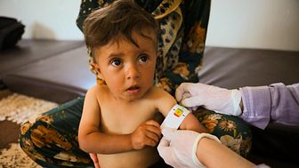 Majad är 18 månader och på bilden mäts hans  arm för att se om han är undernärd.