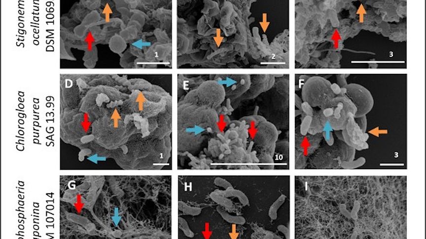 Elektronenmikroskopische Aufnahmen von drei nicht-axenischen Cyanobakterien. Assoziierte Kokken, Spirillen und stäbchen-förmige Bakterien sind durch Pfeile gekennzeichnet (HZI/M. Rohde & DSMZ/J. Petersen)