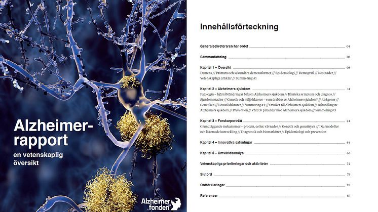 Sveriges första Alzheimerrapport ska öka kunskapen om demenssjukdomar