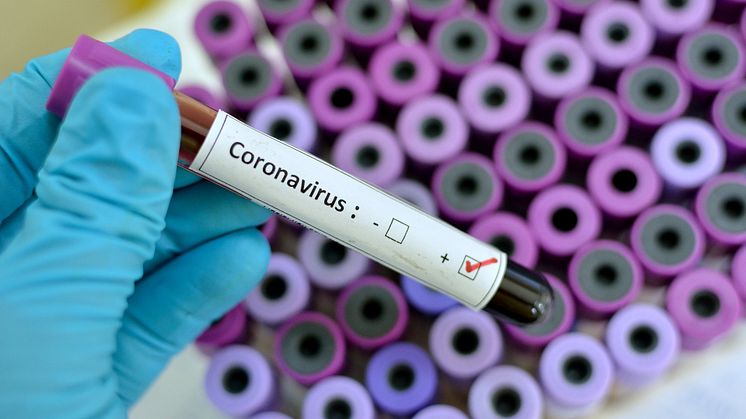 Linköpings universitet har flera forskare som från olika perspektiv kan kommentera coronaviruset SARS-CoV-2 och covid-19