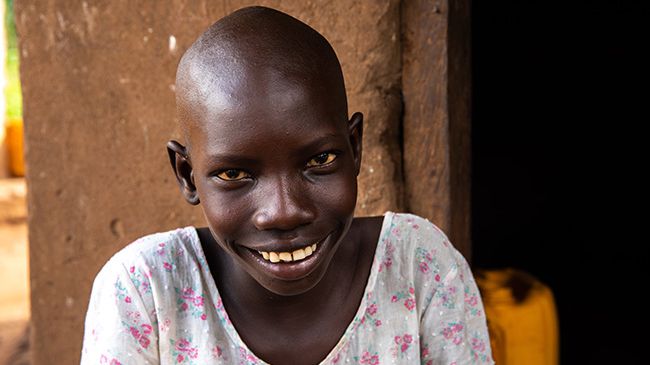 Mädchen mit Nickkrankheit im Südsudan.