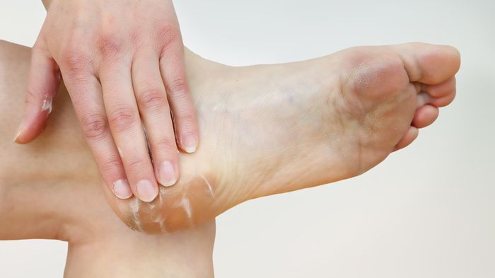 Um Fußproblemen vorzubeugen, sollten Diabetiker ihre Füße jeden Tag eincremen. Bild: Edler von Rabenstein | Fotolia