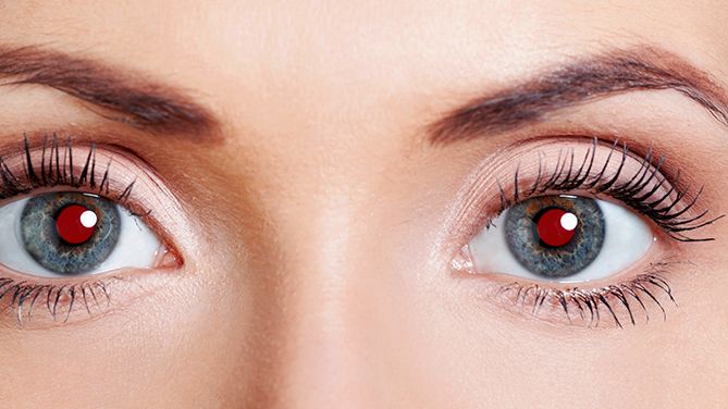 Der Rote-Augen-Effekt