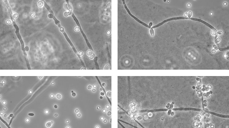 Lichtmikroskopische Bilder des Hefepilzes Candida albicans (DSM 1386); Quelle: DSMZ