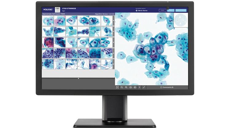 Hologic opnår CE-mærkning af Genius™ Digital Diagnostics System til screening af livmoderhalskræft