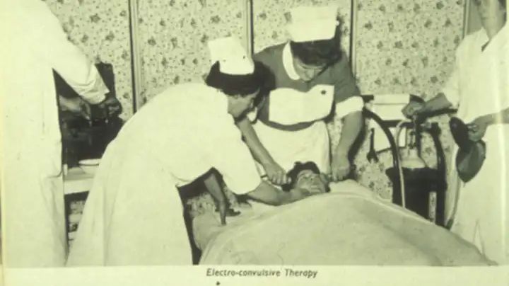 När man kör 470-volt ström genom huvudet på en människa förstår vem som helst att det kan ha allvarliga effekter på hjärnan. Foto: Winwick Hospital, Electroconvulsive therapy, 1957