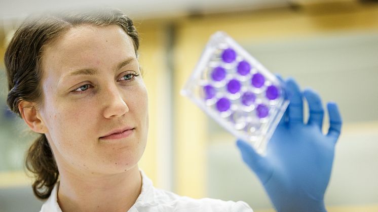 Ebba Rosendal, doktorand vid Institutionen för klinisk mikrobiologi, granskar ett antikroppsprov. Foto: Emil Byström.