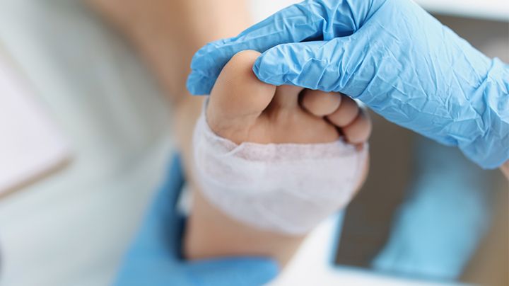 5 von 6 Patienten wissen eigenen Angaben zufolge, dass Diabetes Fußprobleme verursachen kann. Bild: megaflopp | stock.adobe.com