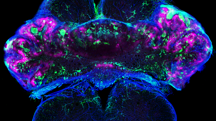 En mushjärna med regioner i hjärnan som saknar syre (hypoxic, magenta) på grund av att blodkärlen (kollagen IV, blått) har blivit tilltäppta med levrat blod (fibrin, grönt). Foto: Fabrizio Orsenigo/Maria Globisch.