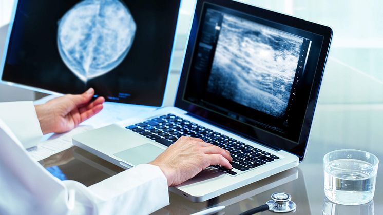 Komplikationer efter operation kan förklara en del av den sämre överlevnaden forskare kunnat se hos patienter som genomgått komplett bröstborttagning, så kallad mastektomi. Det visar en ny studie från Karolinska institutet och SDS Life Science.