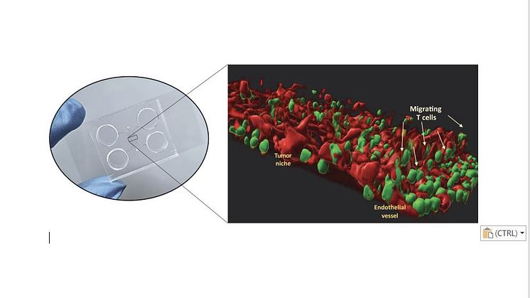 Inside the microfluidic chip, a 3D model replicates the microenvironment in which the tumor thrives, including the endothelial cells and the T cells derived from the patient