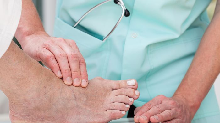 Identifikation von Risikopatienten für das Diabetische Fußsyndrom: bei jeder Untersuchung die Füße und Schuhe kontrollieren
