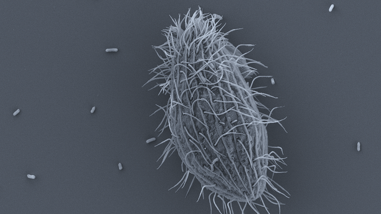Bacteria that can cause disease in humans may benefit from climate change. The picture shows bacteria around a possible host animal (a ciliate). Photo: Karolina Eriksson