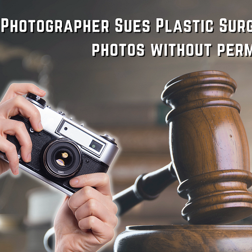 Photographer sues plastic surgeon for using her photos without permission beyond allotted time period