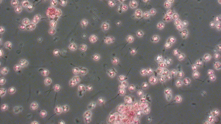 Giftalgen Crysochromulina  leadbatteri sett i mikroskop (Foto: NIVA)