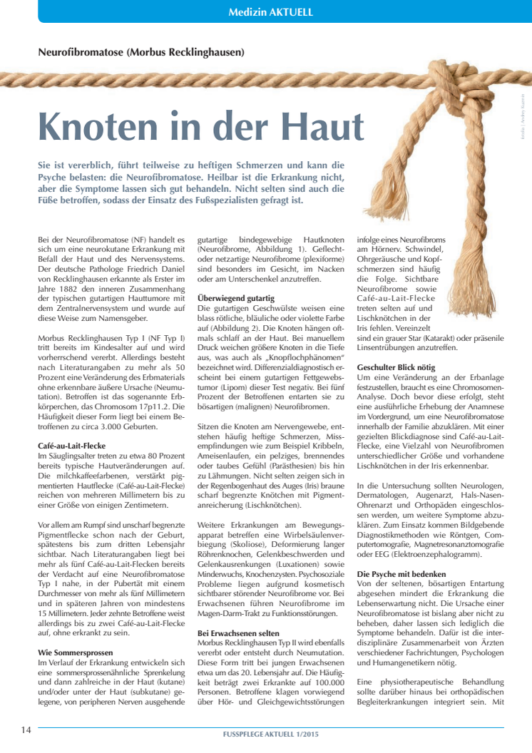 Neurofibromatose (Morbus Recklinghausen): Knoten in der Haut