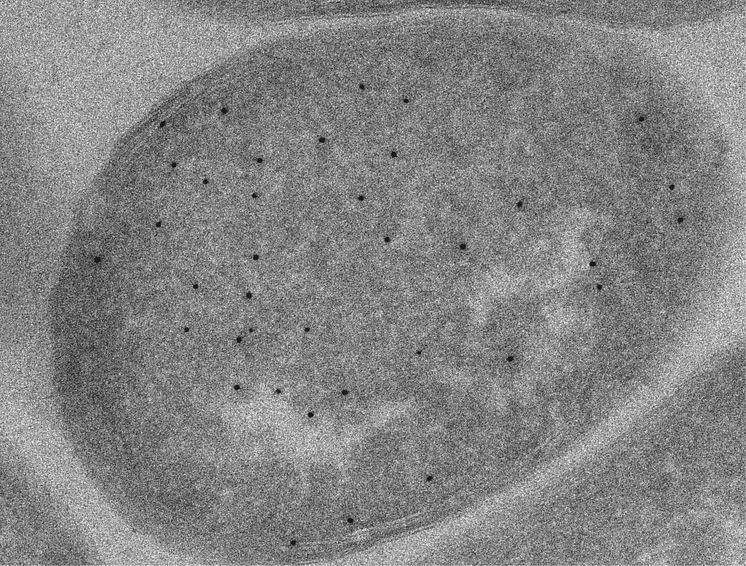 YopN i subbakteriell lokalisering i elektronmikroskop