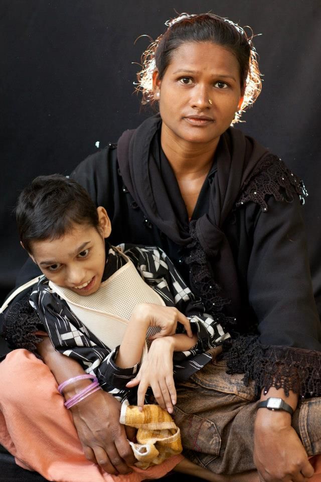 Mother and child at Chingari Trust, Bhopal. Photo Alex Masi